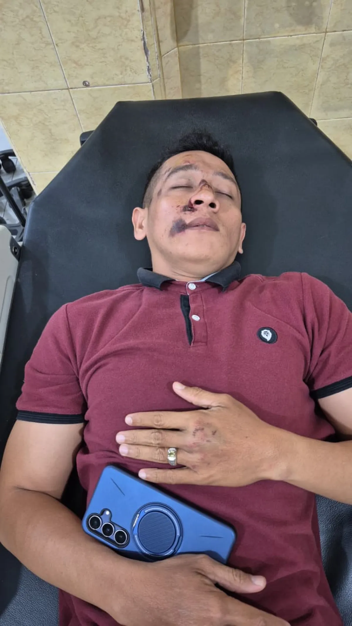 Perawat RS Graha Sehat Kraksaan Jadi Korban Dugaan Penganiayaan, Pelaku Diamankan Polisi